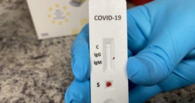 Teste rápido coronavirus