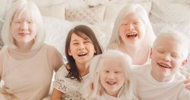 Dia Internacional de Conscientização sobre o Albinismo