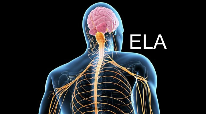A Esclerose Lateral Amiotrófica (ELA) é uma doença neurodegenerativa progressiva e fatal, caracterizada pela degeneração dos neurônios motores.